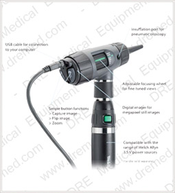 Welch Allyn Digital MacroView Otoscope detailed